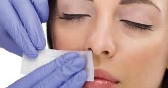 Arzt zeigt, wie Damenbart entfernen funktioniert