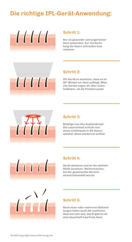 Die richtige IPL Gerät Anwendung