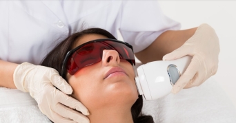 Anwendung eines Diodenlasers als Haar-Laser